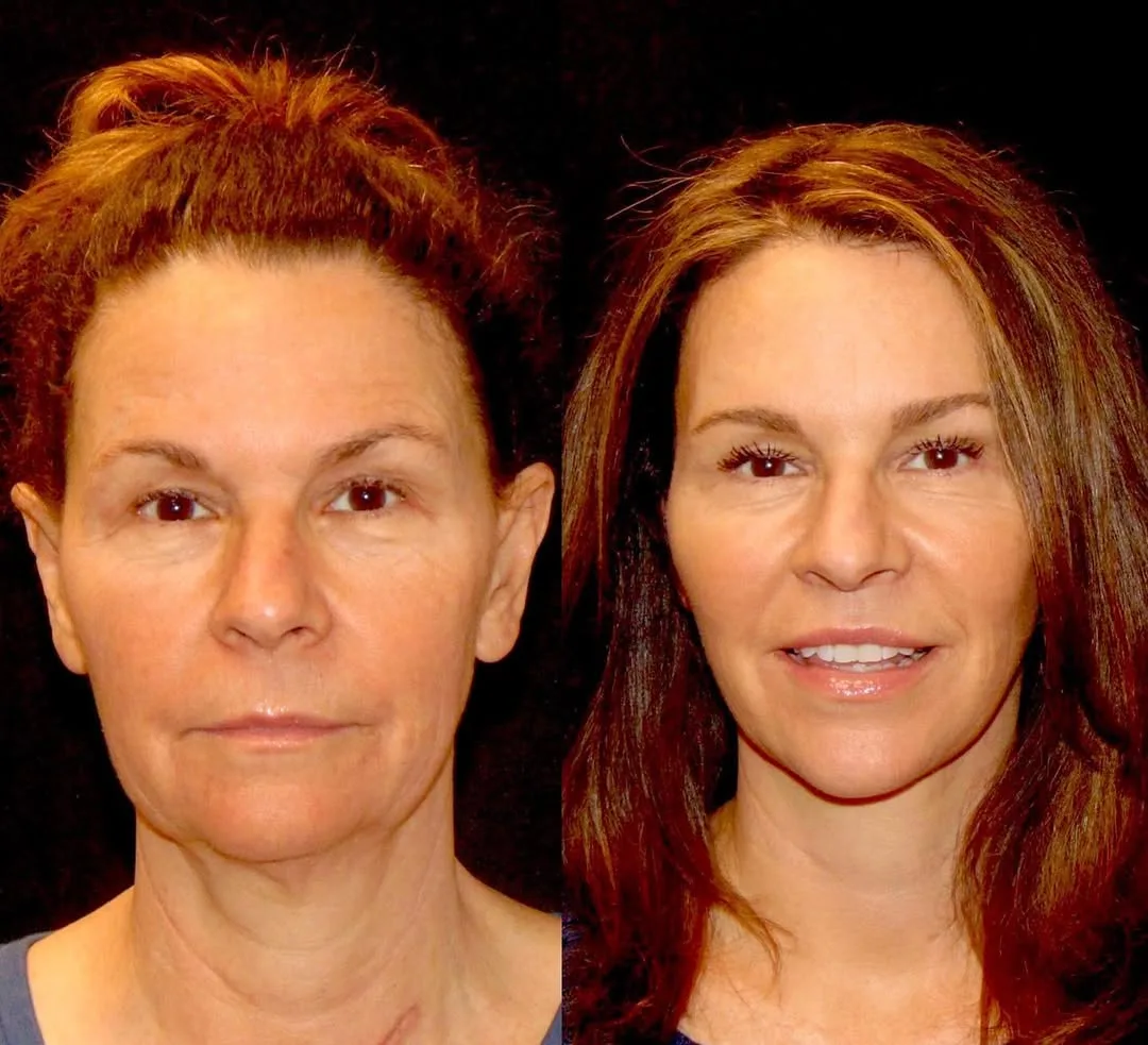 Before and after — Dr. Roy David