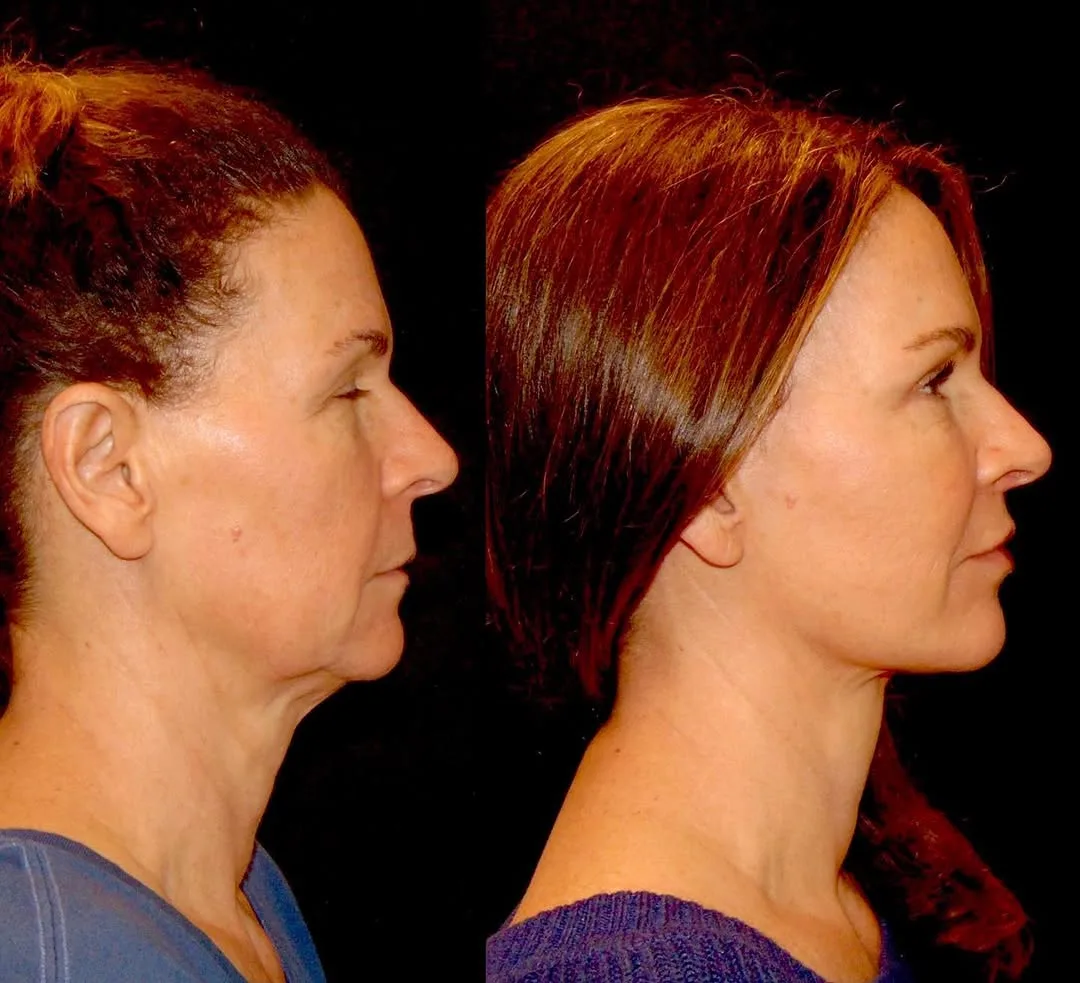 Before and after — Dr. Roy David