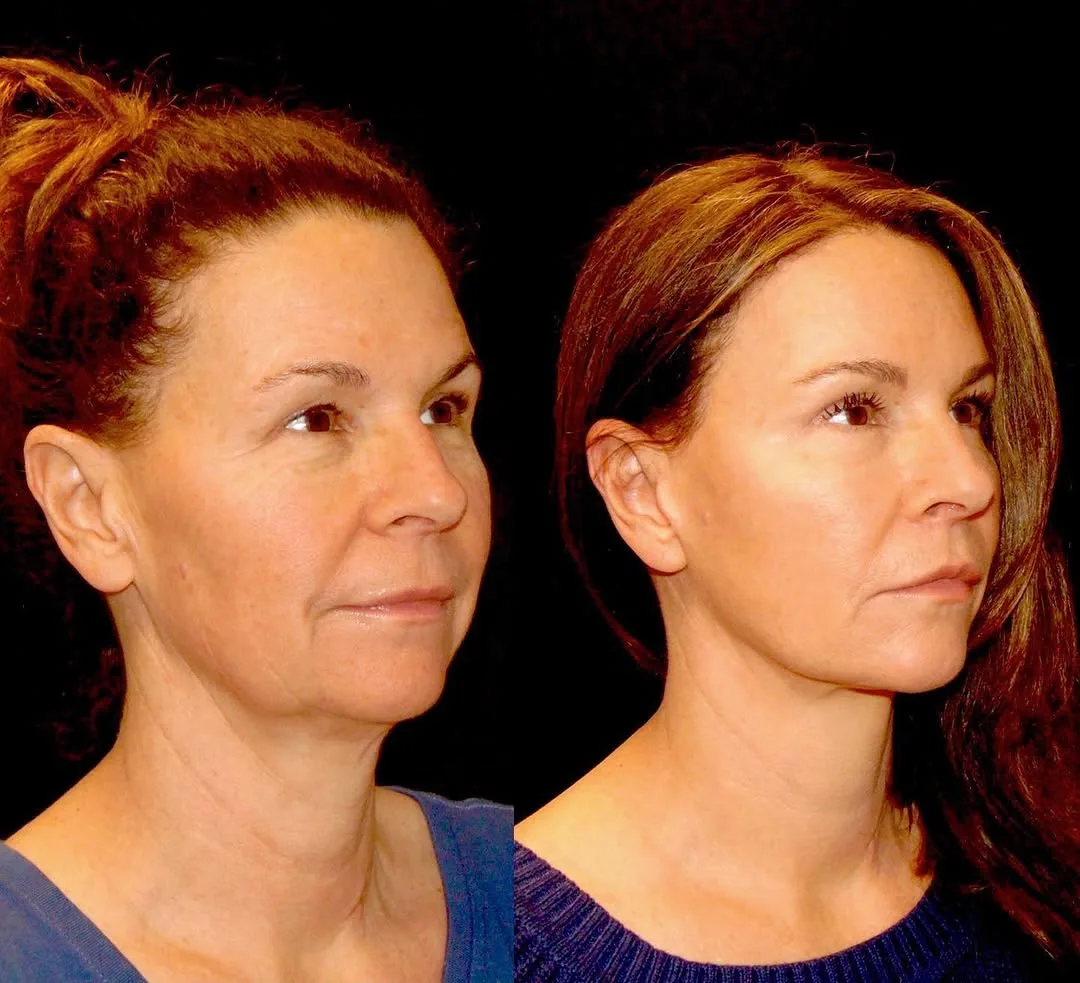 Before and after — Dr. Roy David