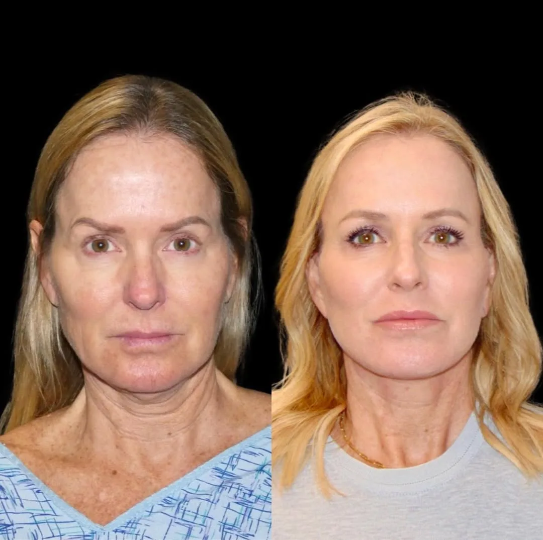 Before and after — Dr. Roy David
