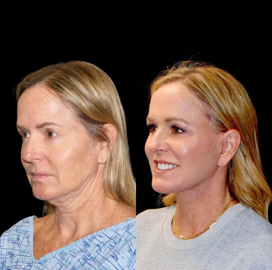 Before and after — Dr. Roy David