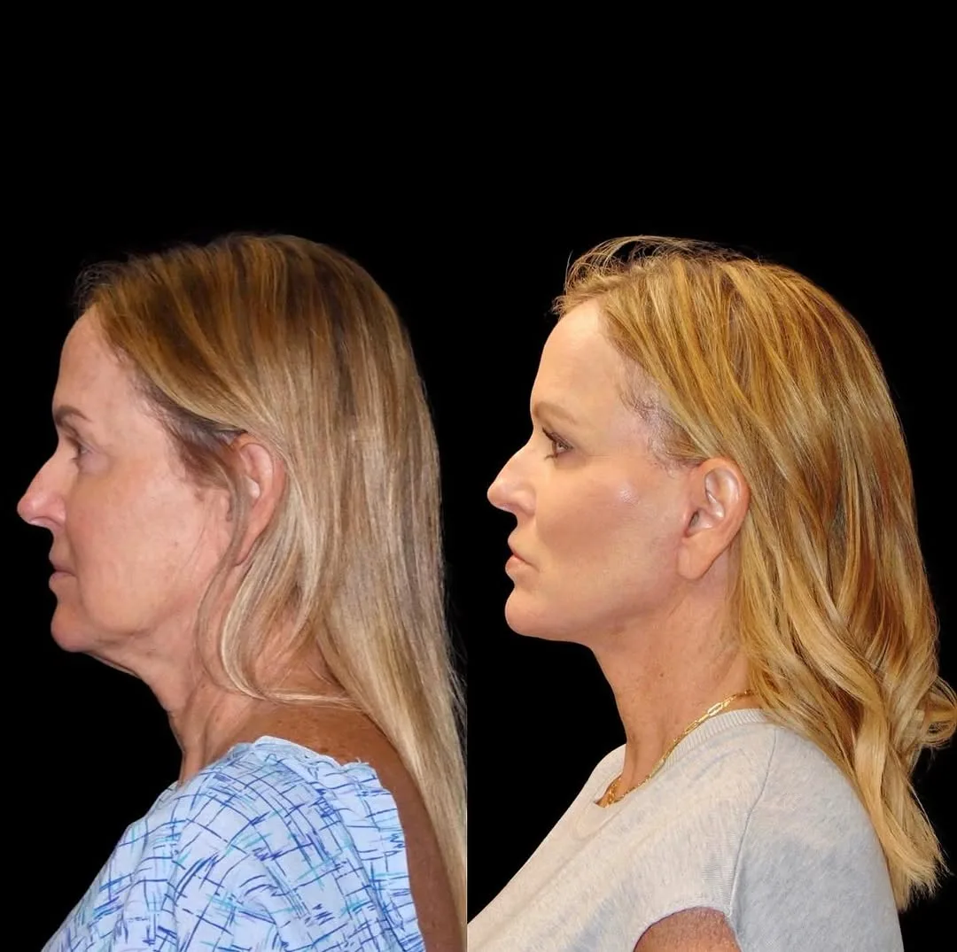Before and after — Dr. Roy David