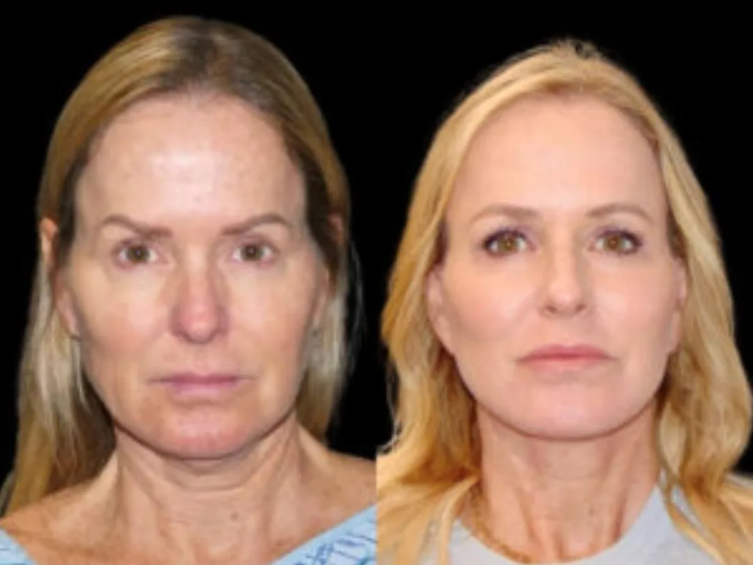 Before and after — Dr. Roy David