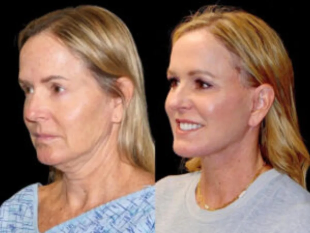 Before and after — Dr. Roy David