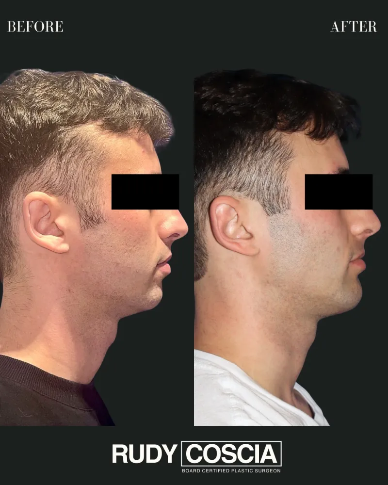 Before and after — Dr. Rudy Coscia