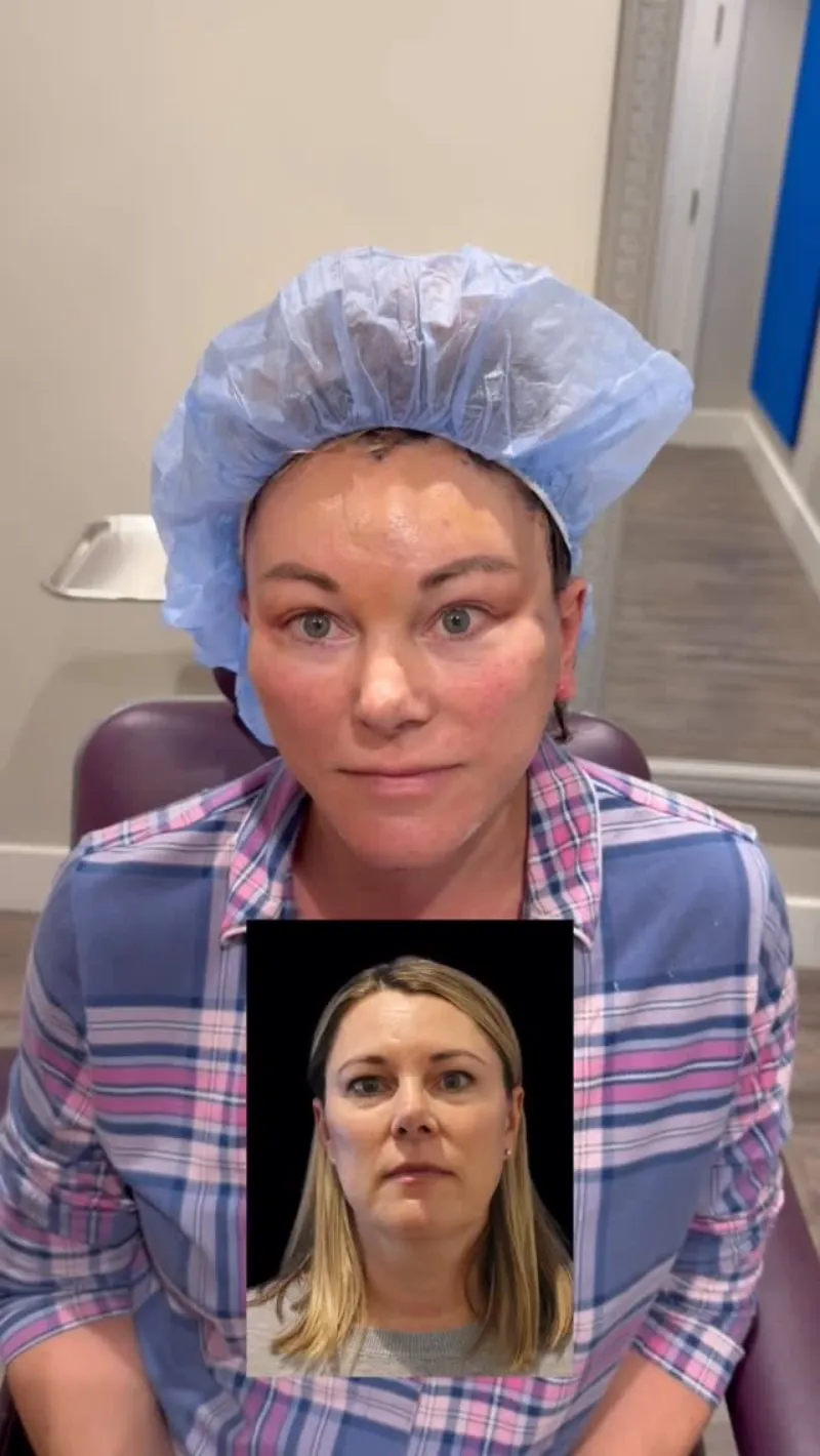 Before and after — Dr. Rudy Coscia