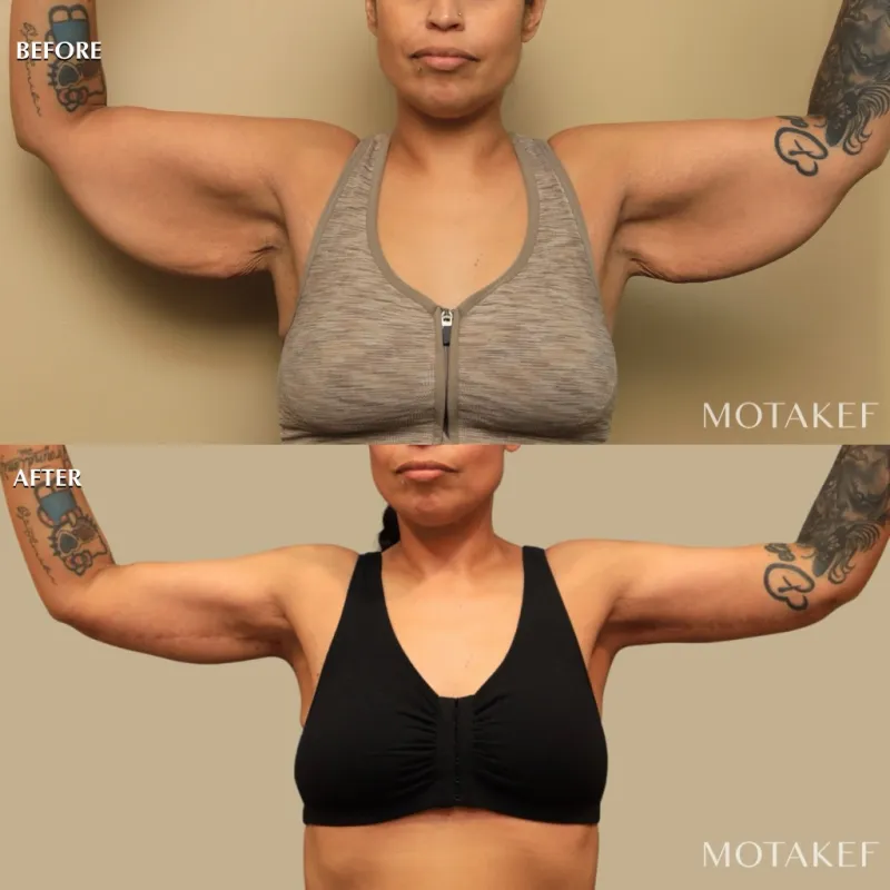 Before and after — Dr. Saba Motakef