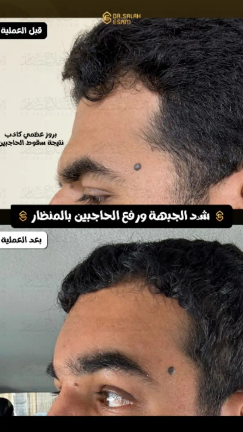 Before and after: Dr. Salah Esam