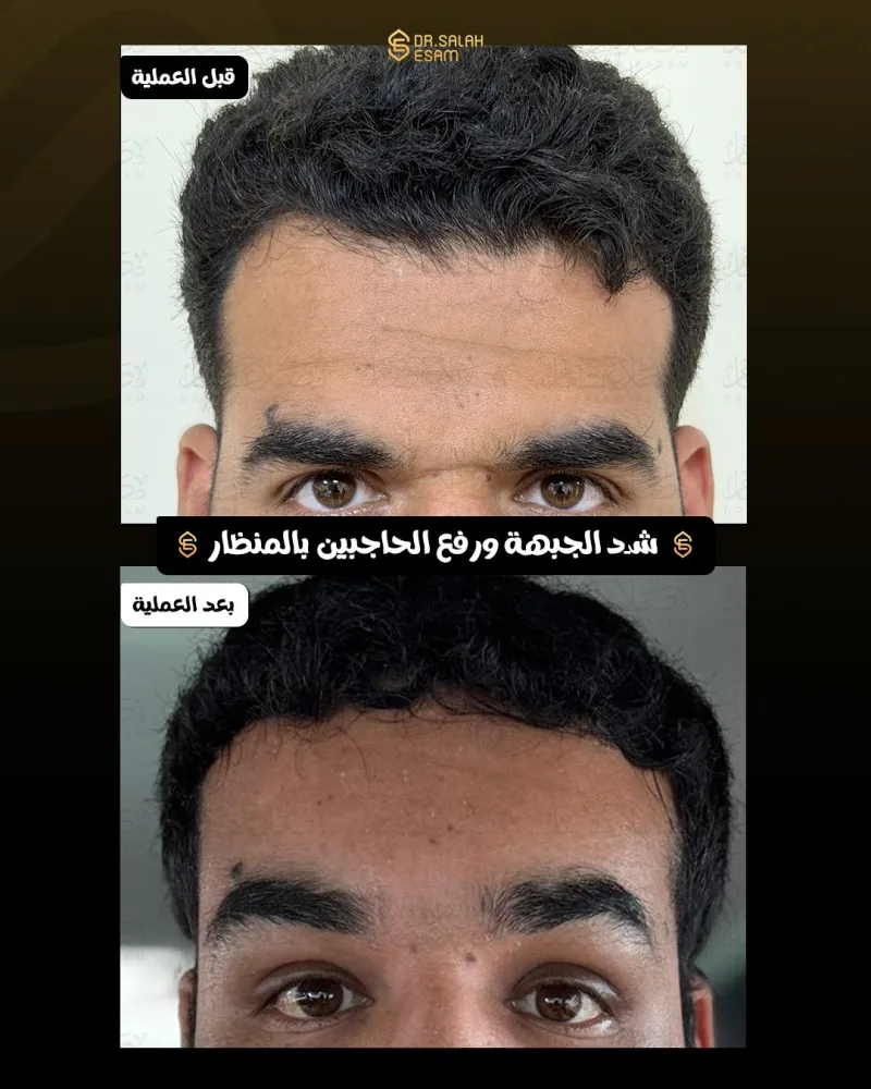 Before and after: Dr. Salah Esam