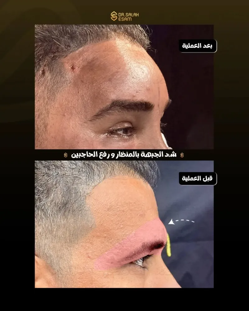 Before and after: Dr. Salah Esam
