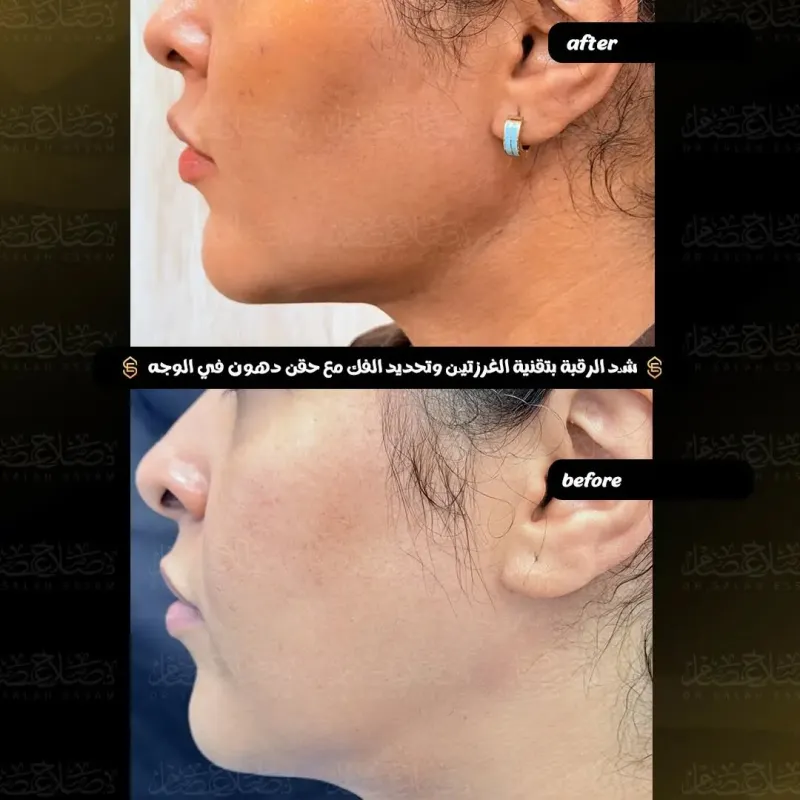 Before and after: Dr. Salah Esam