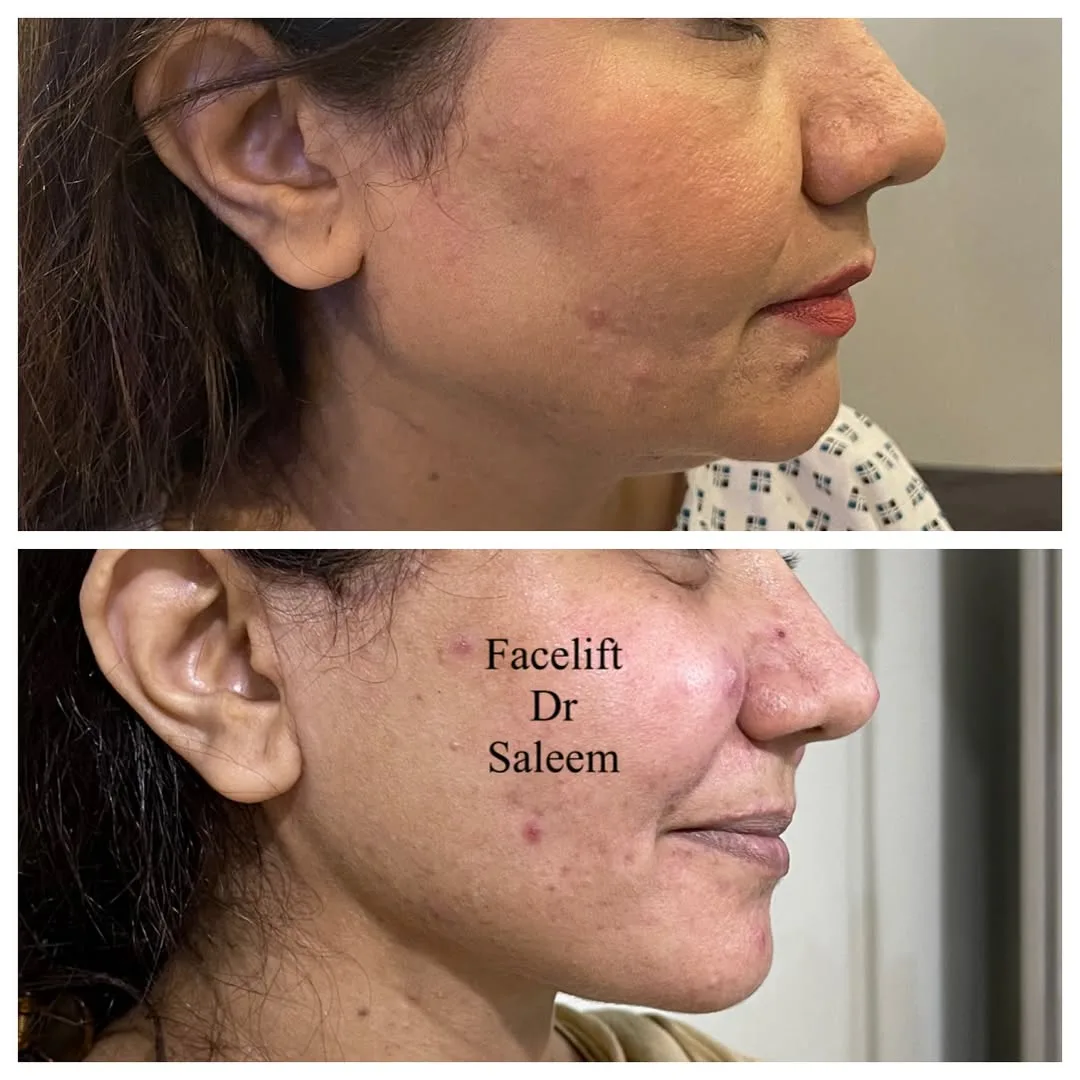Before and after — Dr. Muhammad Saleem