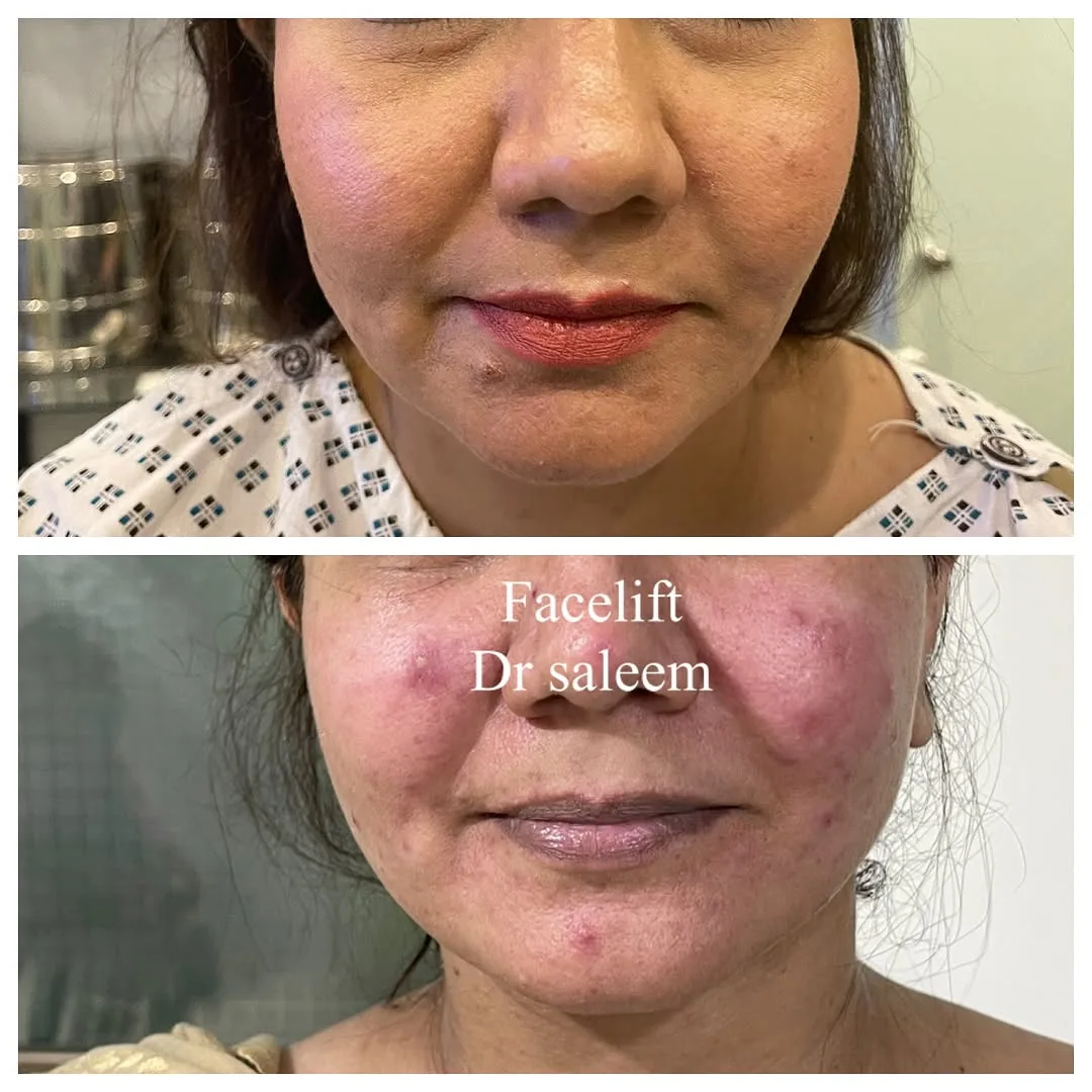 Before and after — Dr. Muhammad Saleem