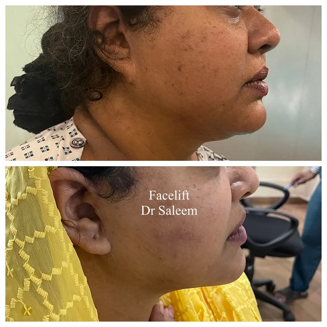 Before and after — Dr. Muhammad Saleem