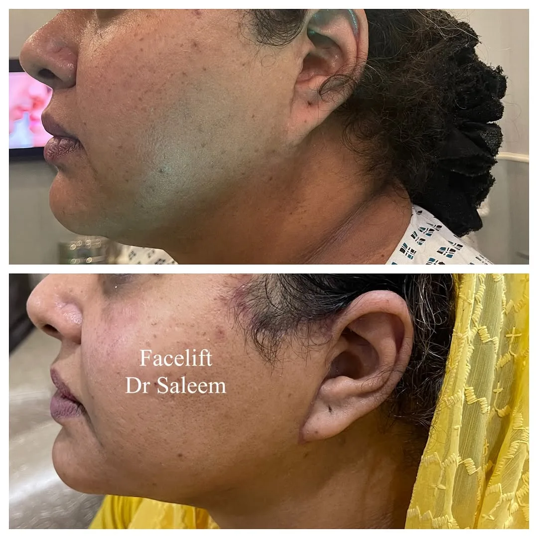 Before and after — Dr. Muhammad Saleem