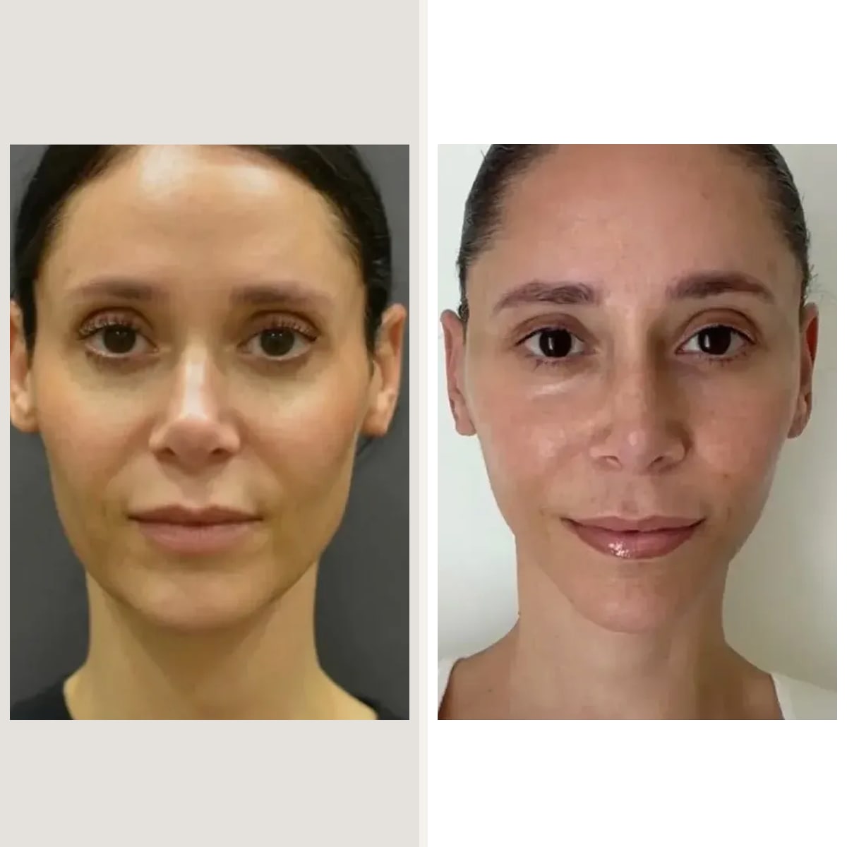 Before and after: Dr. Sam Rizk