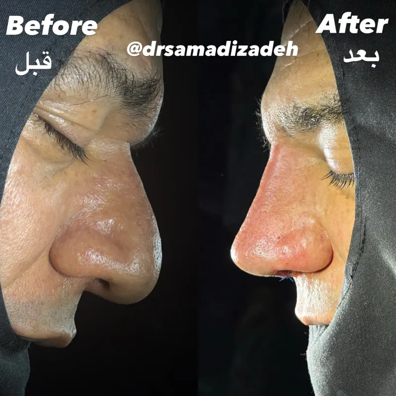 Before and after — Dr. Samad Samadizadeh