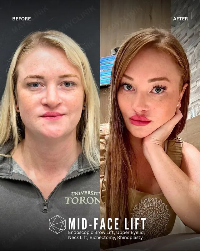 Before and after — Dr. Samet Şendur