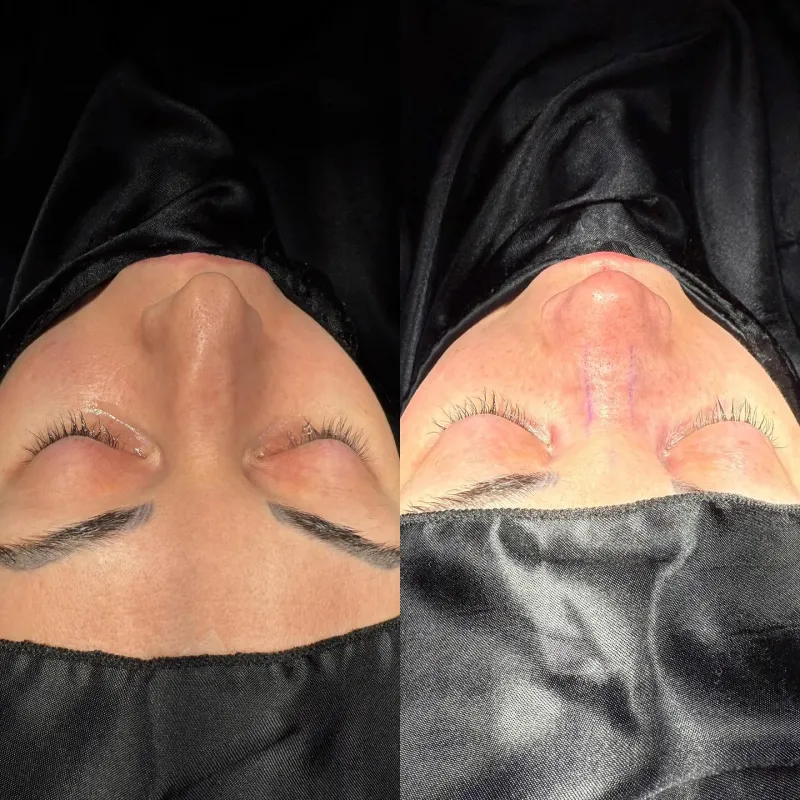 Before and after — Dr. Sami Moubayed