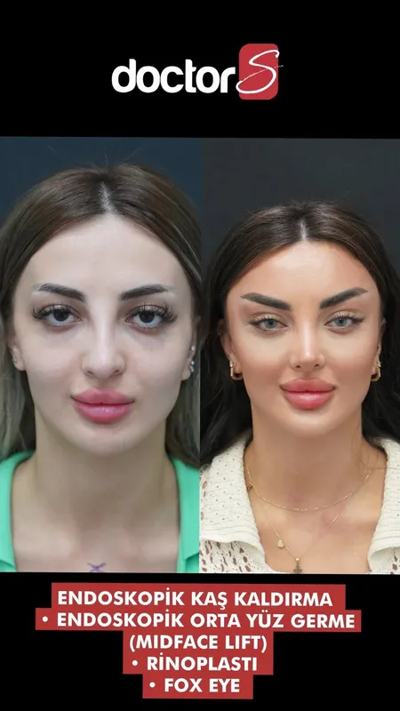 Before and after — Dr. Sami Samin