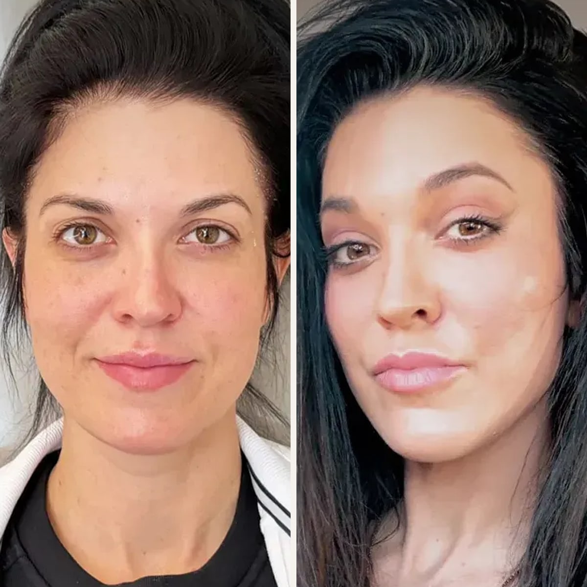 Before and after: Dr. Şamil Yazgan