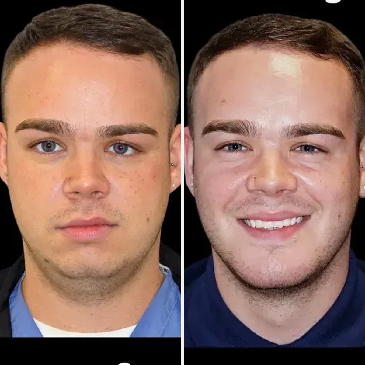 Before and after: Dr. Samuel Mattine
