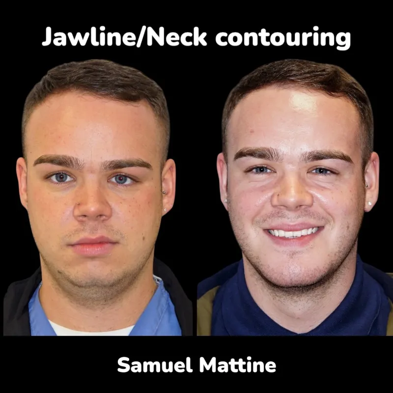 Before and after — Dr. Samuel Mattine