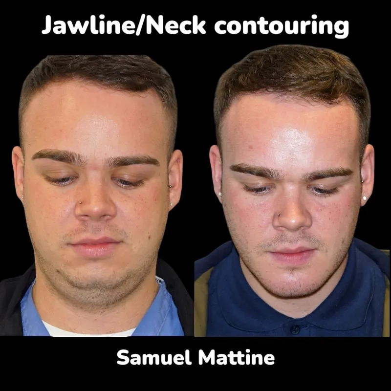 Before and after — Dr. Samuel Mattine