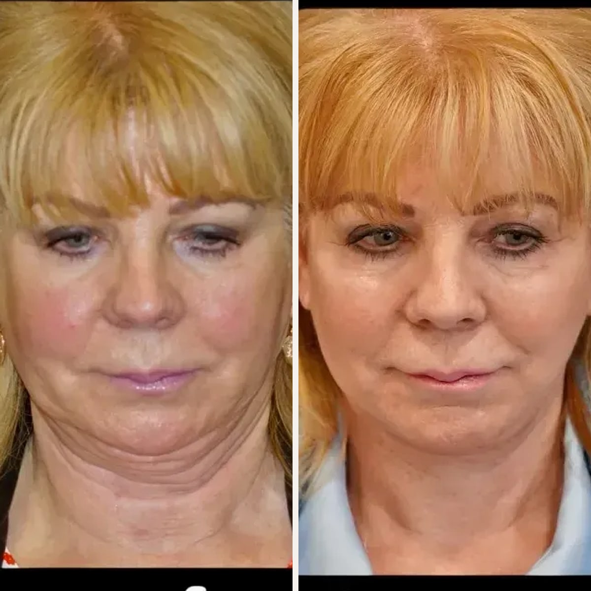 Before and after: Dr. Samuel Mattine