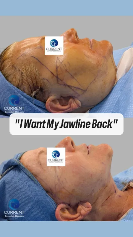 Before and after — Dr. Sarah Novis