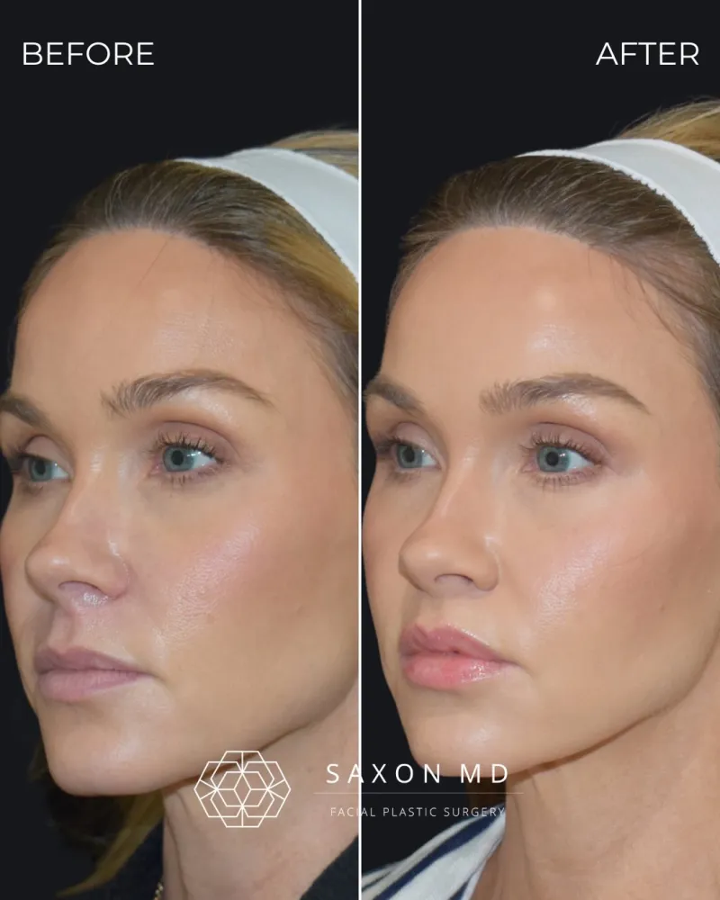 Before and after: Dr. Sarah Saxon