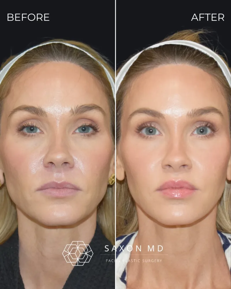 Before and after: Dr. Sarah Saxon