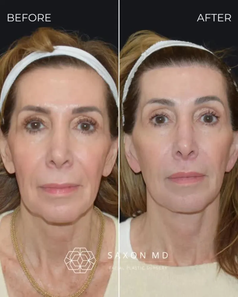 Before and after: Dr. Sarah Saxon
