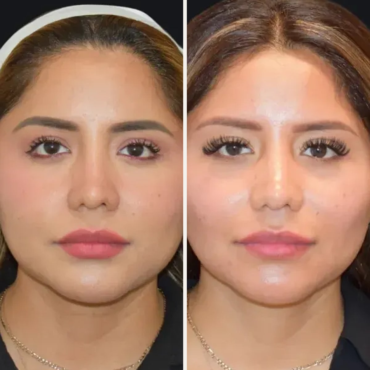 Before and after: Dr. Sarah Saxon