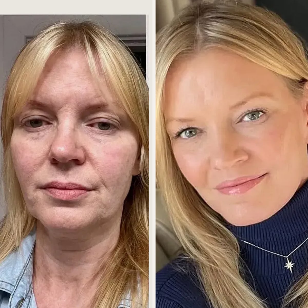 Before and after: Dr. Sean Alemi