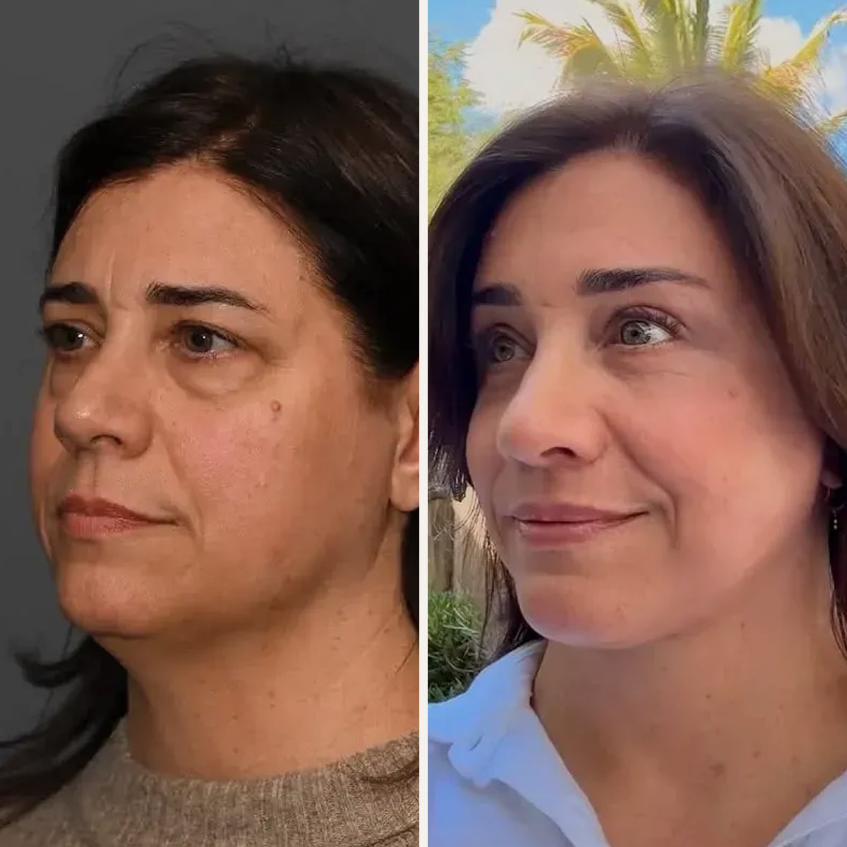 Before and after: Dr. Sean Alemi