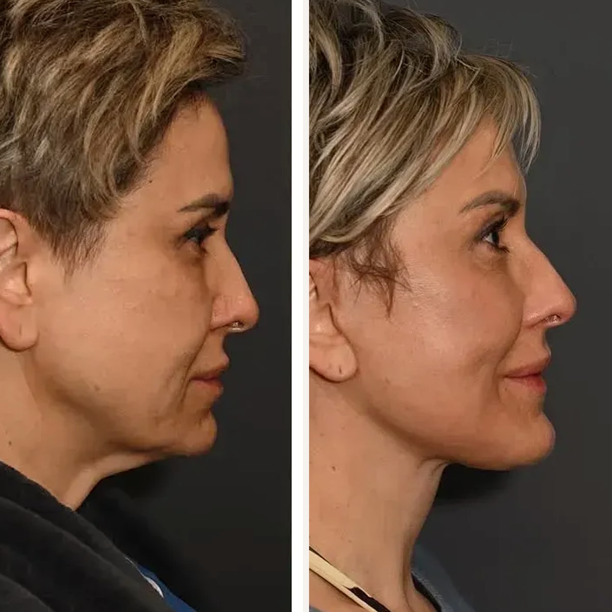 Before and after: Dr. Sean Alemi