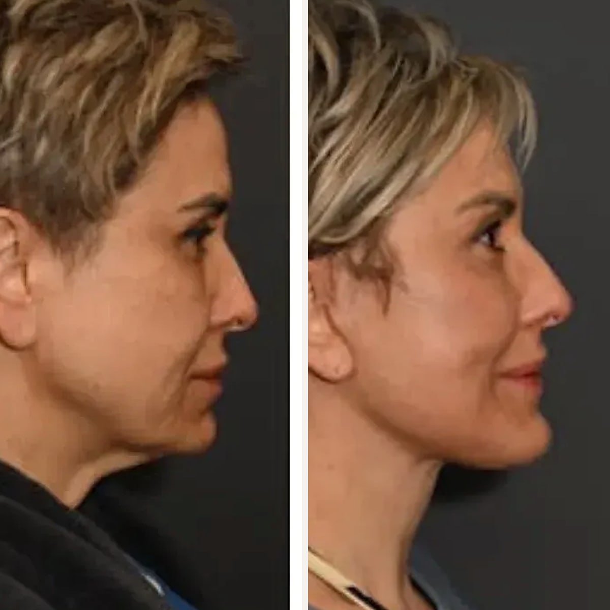 Before and after: Dr. Sean Alemi