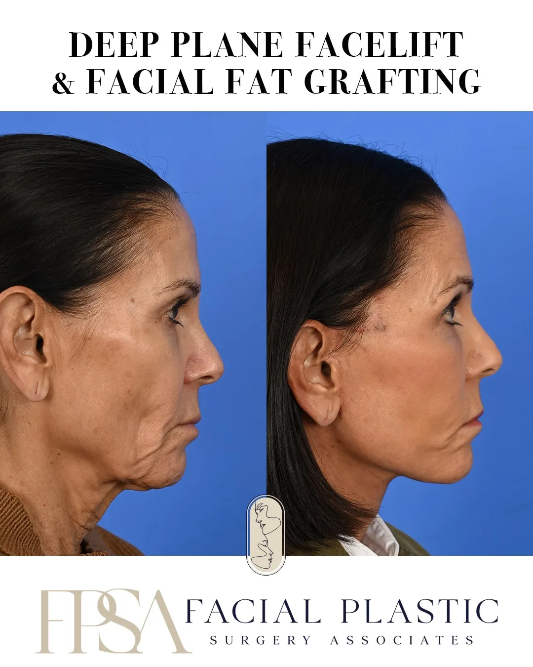 Before and after — Dr. Sean Delaney