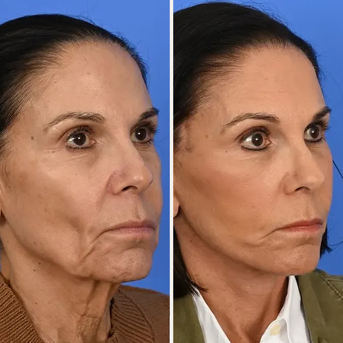 Before and after: Dr. Sean Delaney