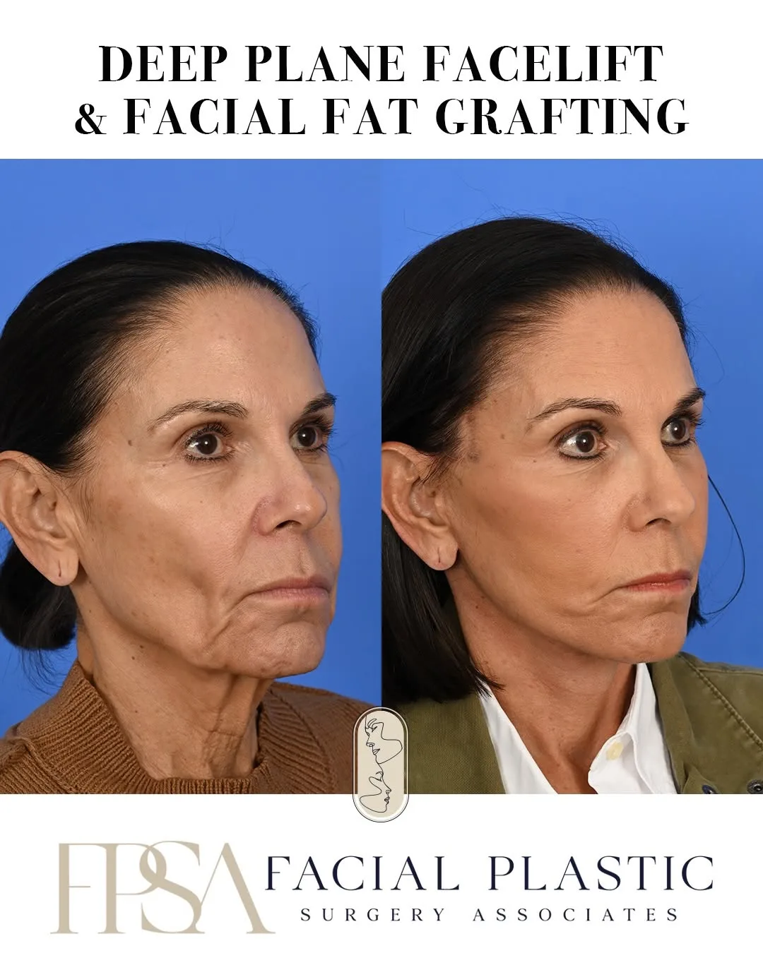Before and after — Dr. Sean Delaney