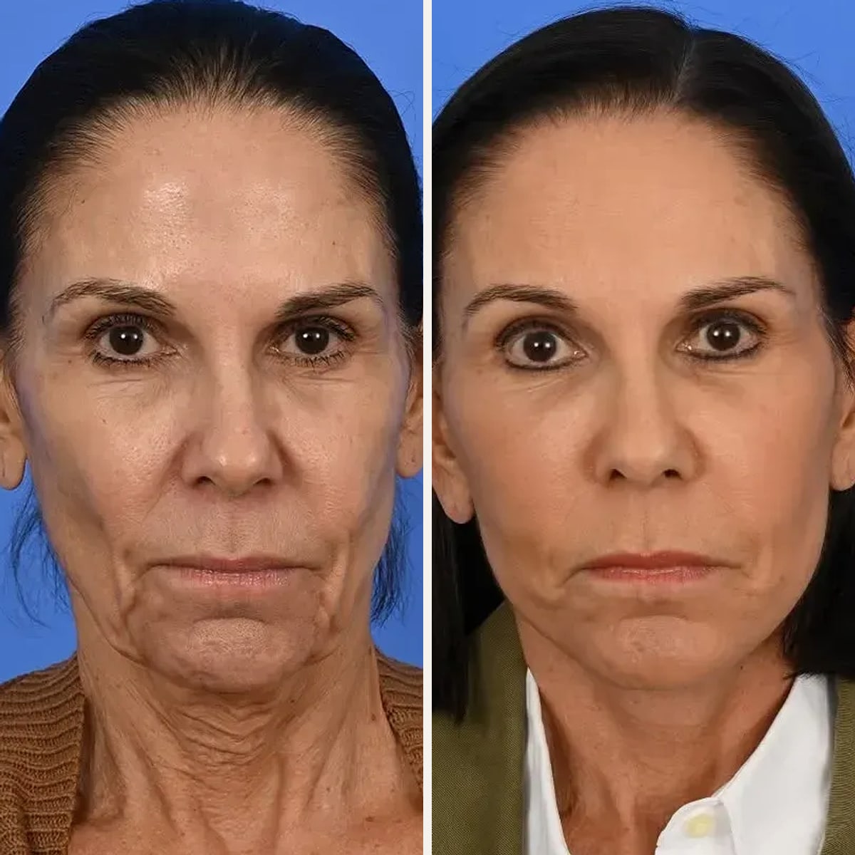 Before and after: Dr. Sean Delaney
