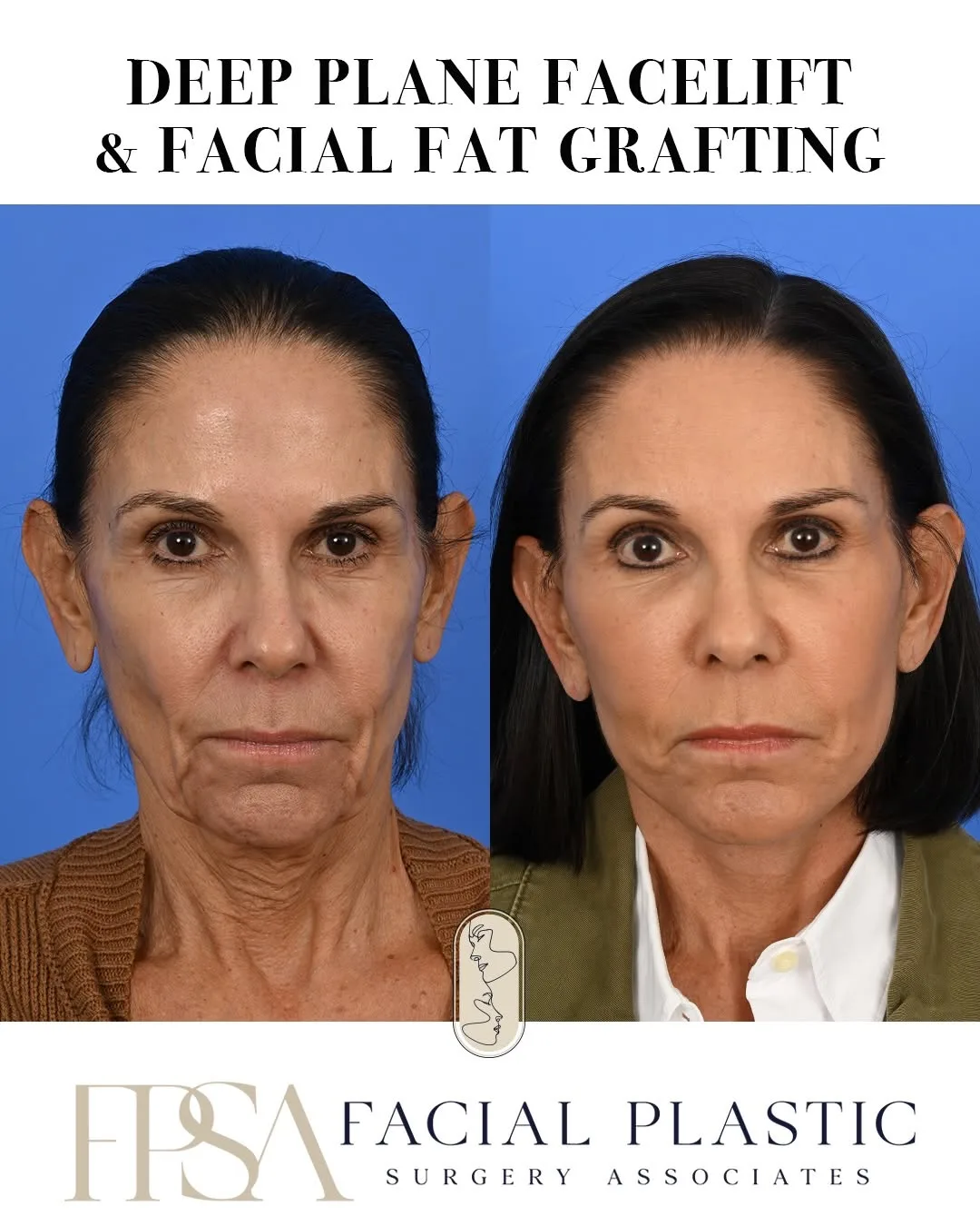 Before and after — Dr. Sean Delaney