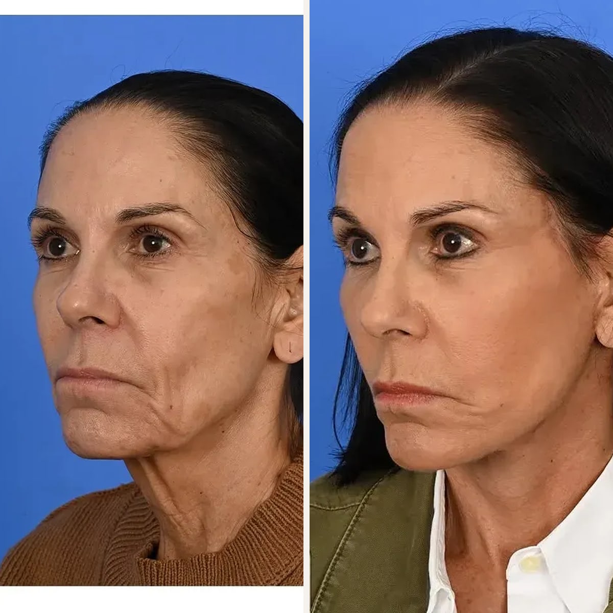 Before and after: Dr. Sean Delaney