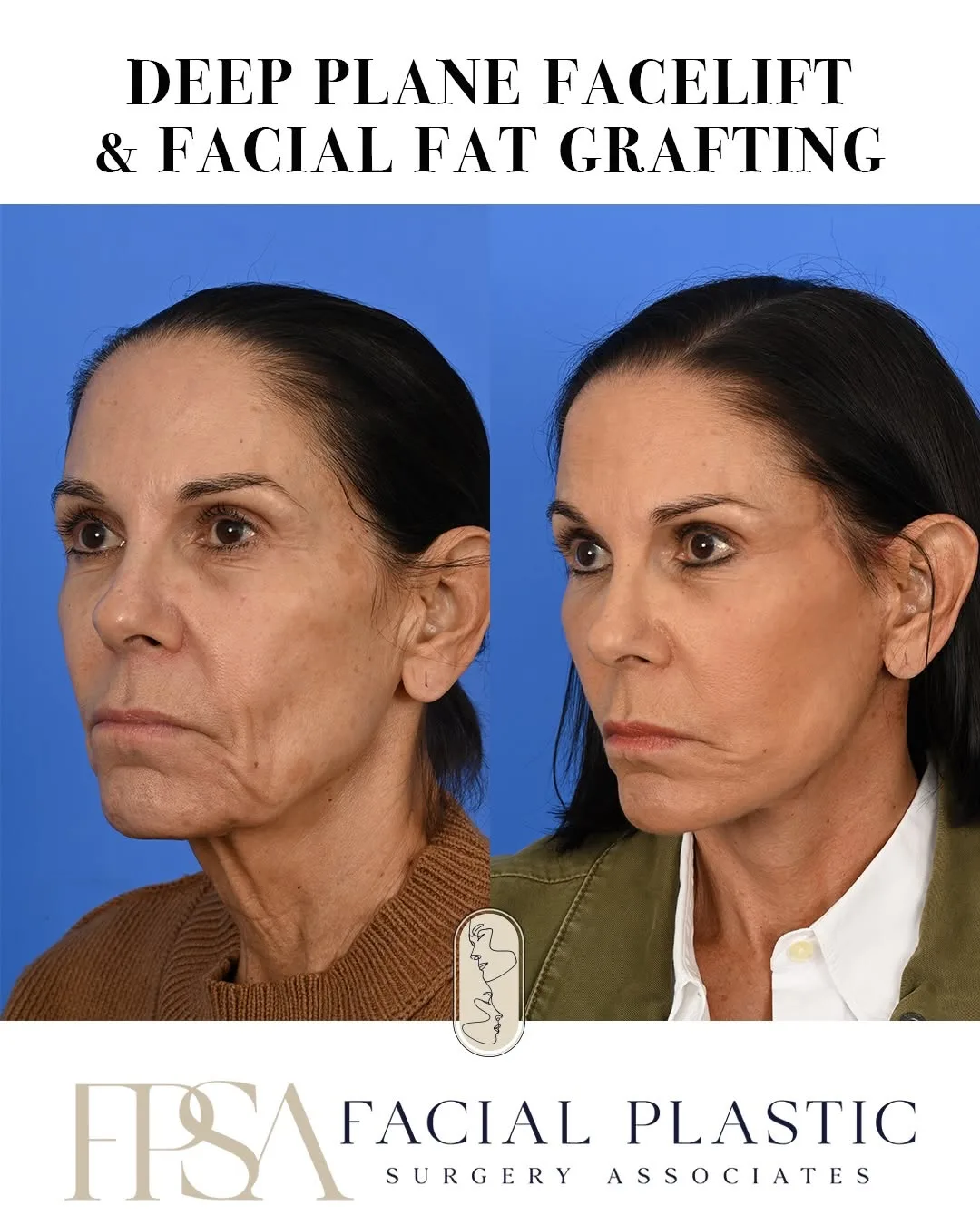 Before and after — Dr. Sean Delaney
