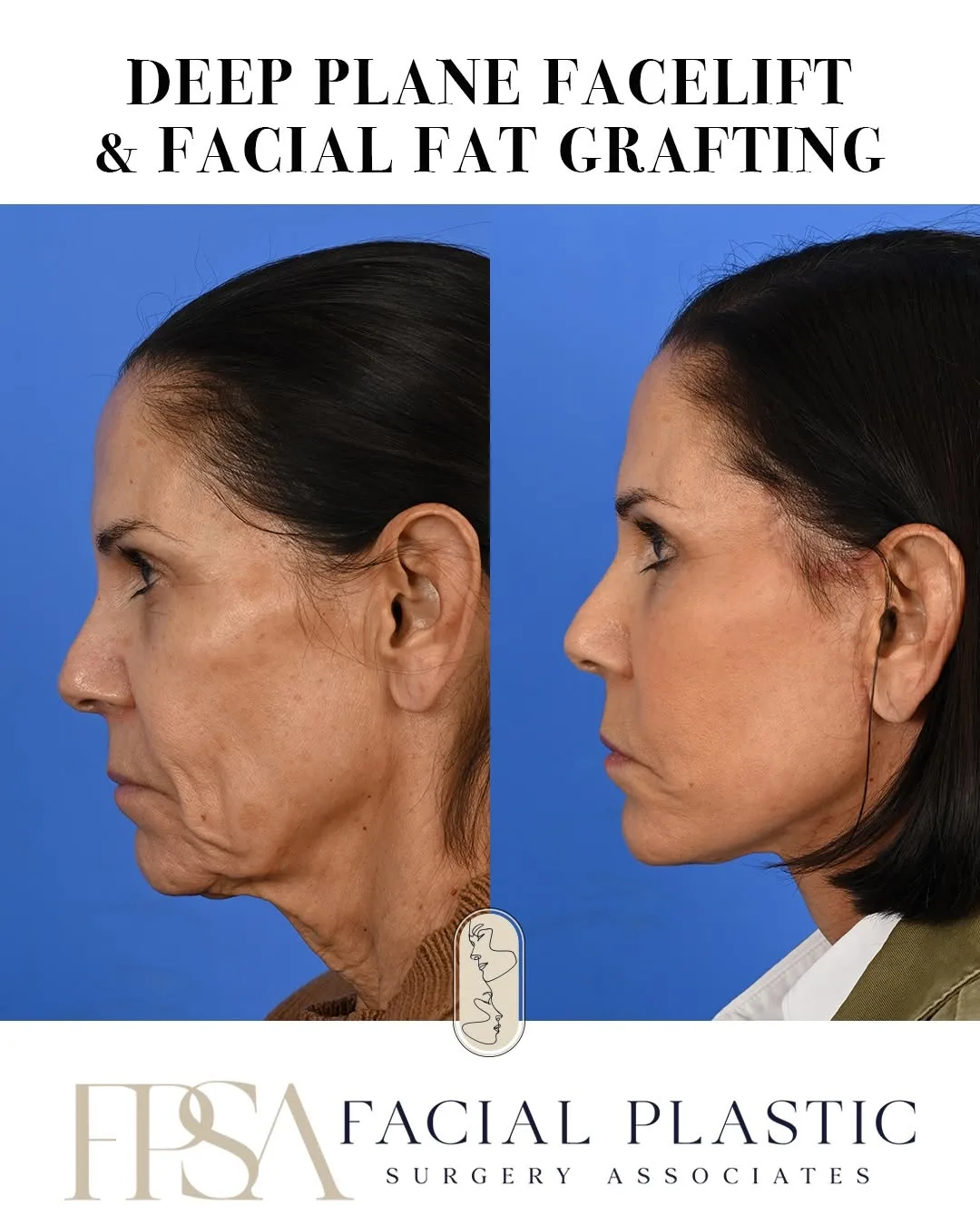 Before and after — Dr. Sean Delaney