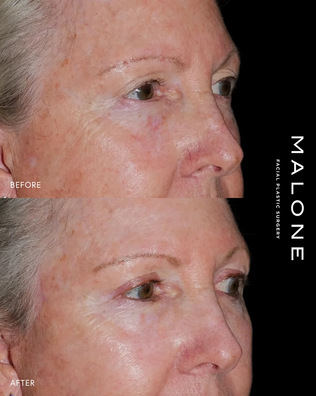 Before and after — Dr. Sean Malone