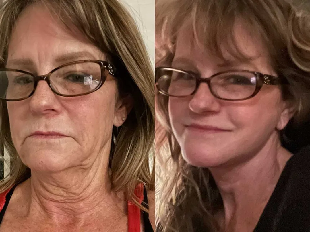 Before and after — Dr. Sean Malone