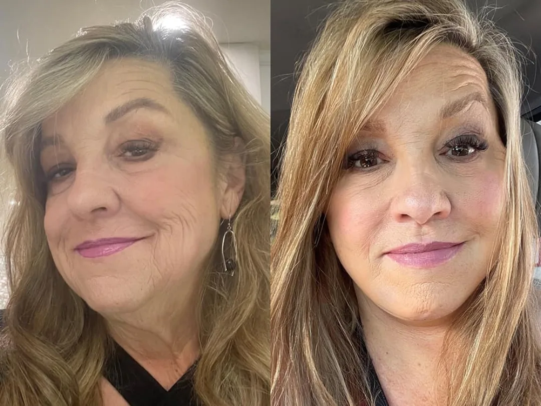 Before and after — Dr. Sean Malone