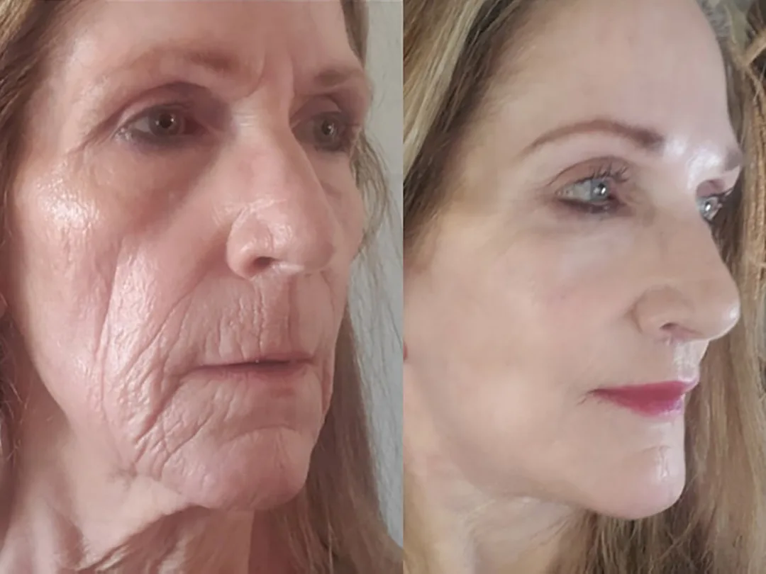 Before and after — Dr. Sean Malone